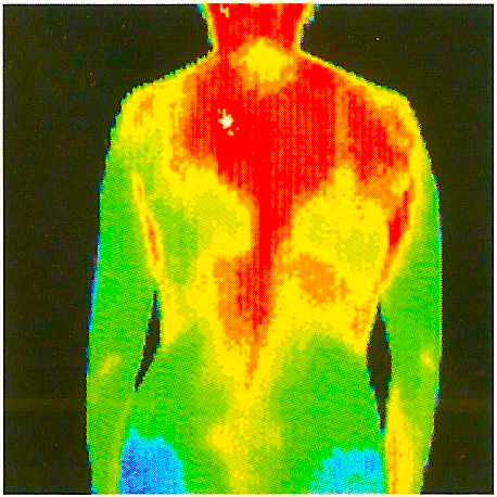 Thermal image of back