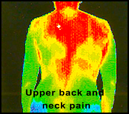 image of thermal back scan