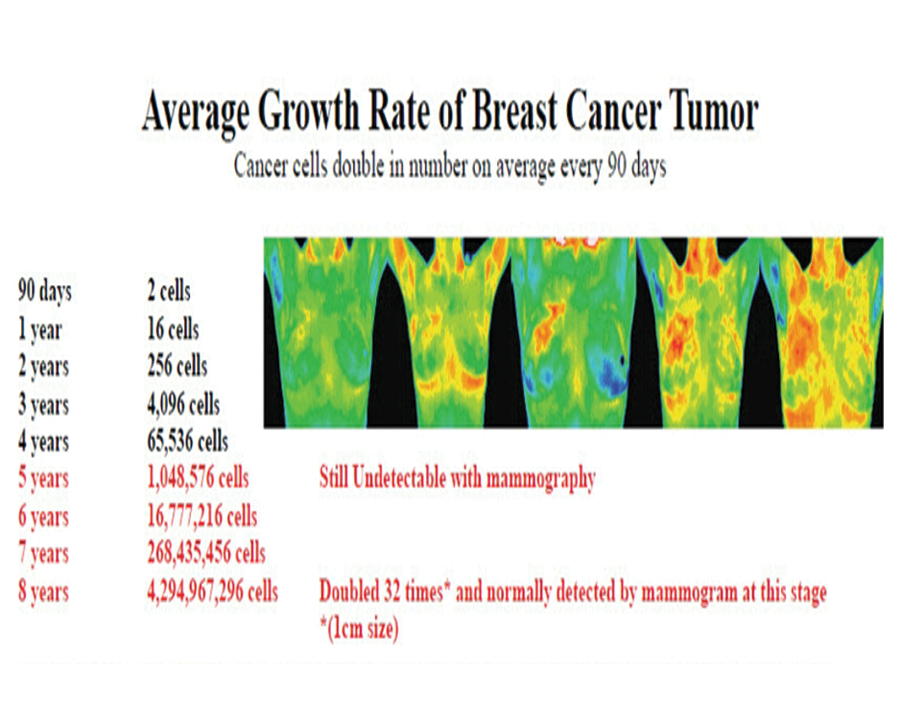 Image of Breast Cancer Graph