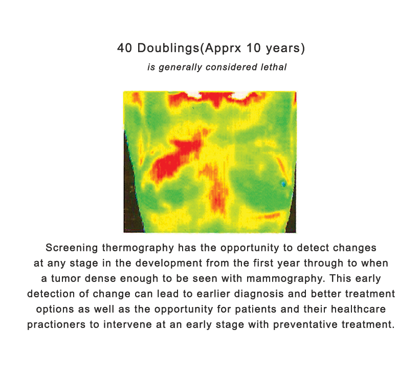 Image of Thermal Imaging Breast Cancer
