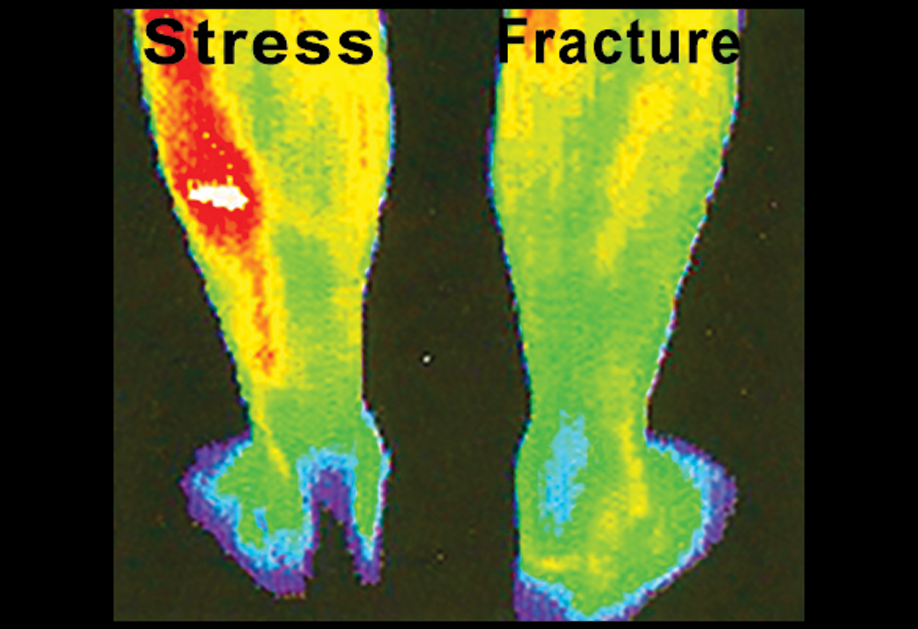 image of stress fracture