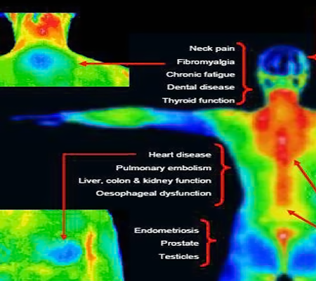 image of various thermal body disorders