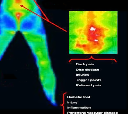 image of thermal lower body issues