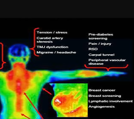 image of various thermal body disorders